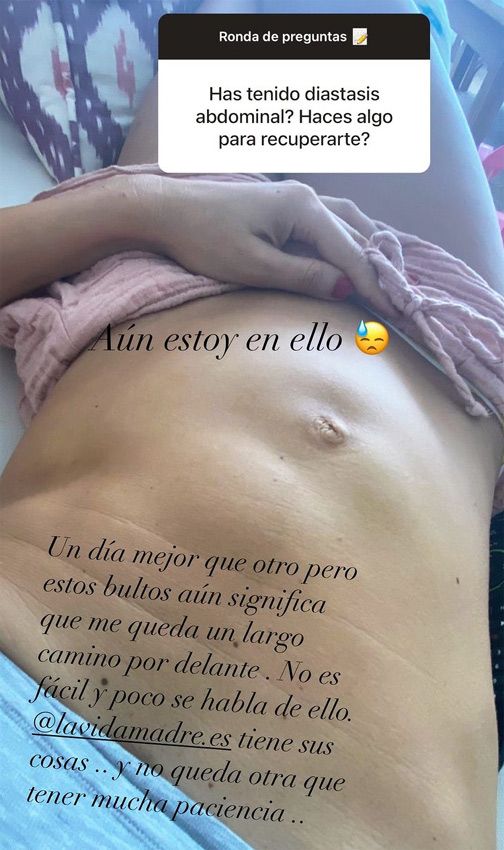 Ariadne Artiles muestra cómo está su cuerpo