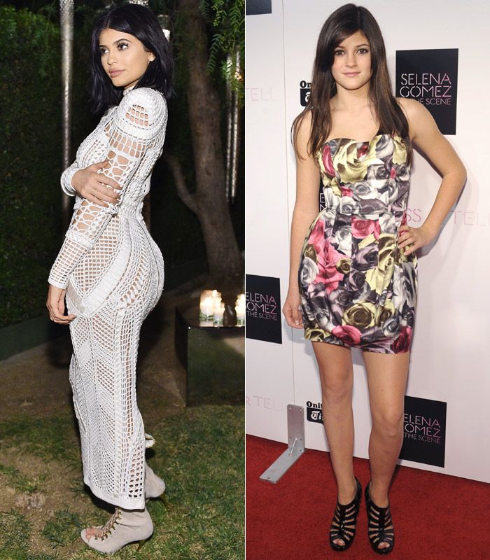 Increíble transformación de Kylie Jenner. Entre estas dos imágenes han pasado sólo seis años y es sorprendente lo mucho que ha cambiado su físico.
