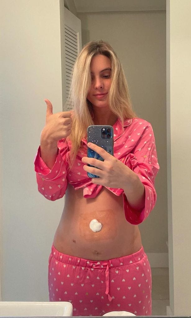 Lele Pons tras su cirugía de apéndice