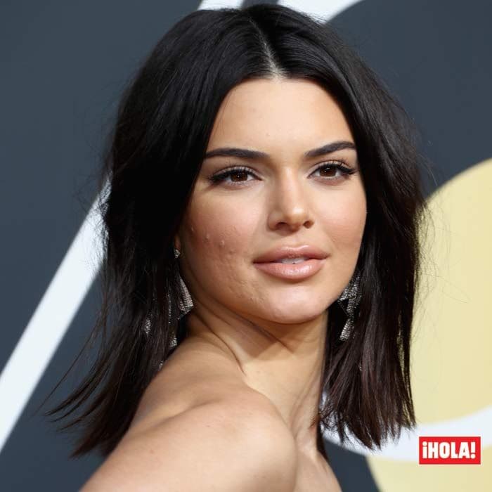 Kendall Jenner acné