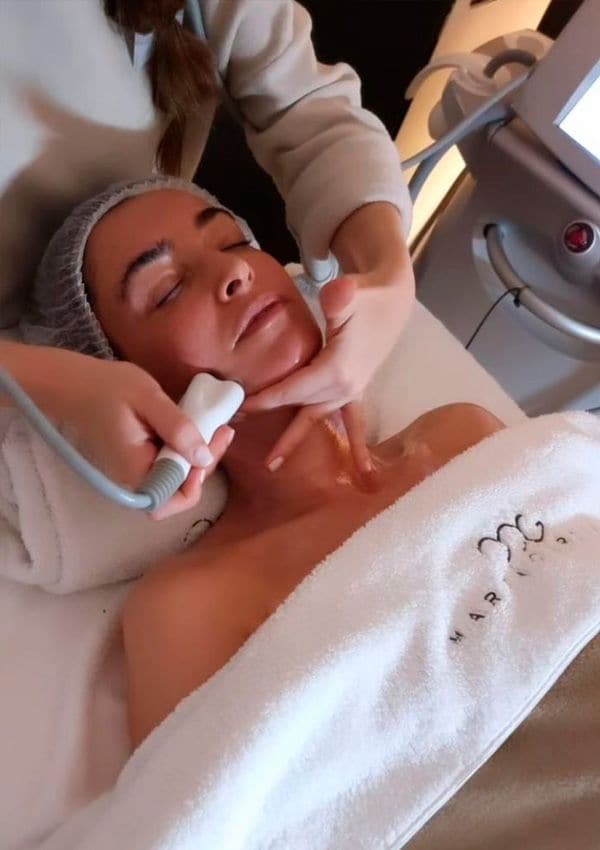 blanca romero facial