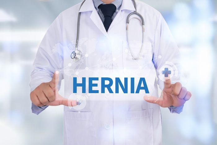 hernia