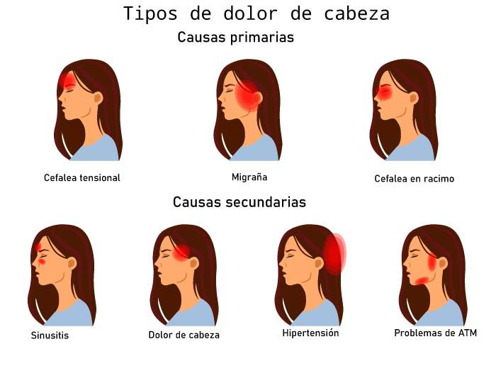 dolor-cabeza