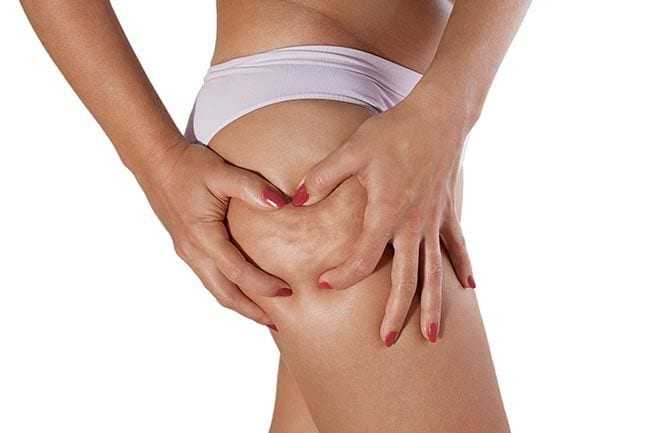 5 tipos de ejercicio para combatir la celulitis de forma eficaz 