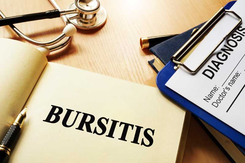 bursitis