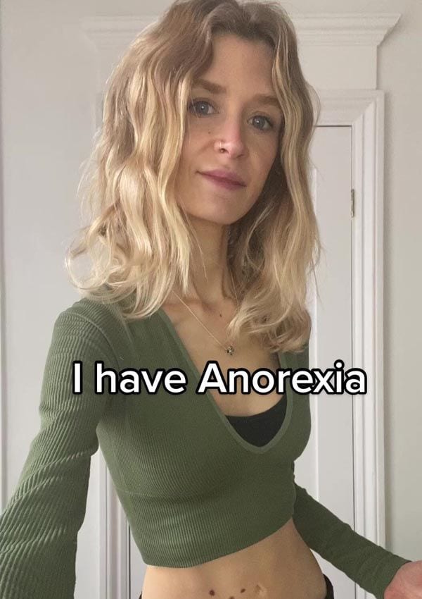 Por qué visibilizar la anorexia y los TCA
