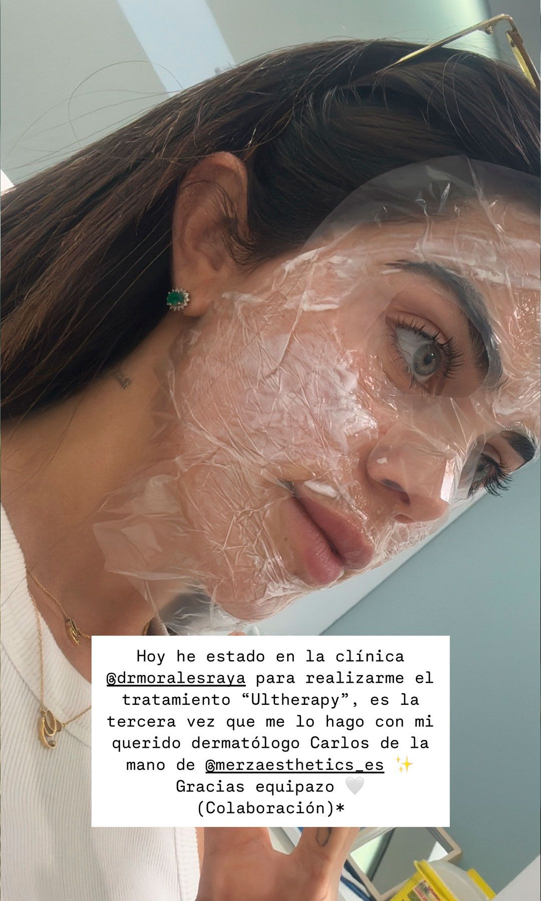 Violeta Mangriñan haciéndose Ultherapy