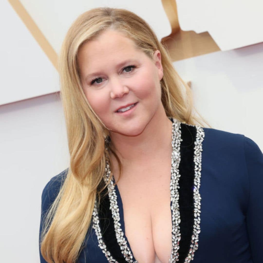 Amy Schumer revela que padece el síndrome de Cushing tras la hinchazón de su cara en sus últimas apariciones