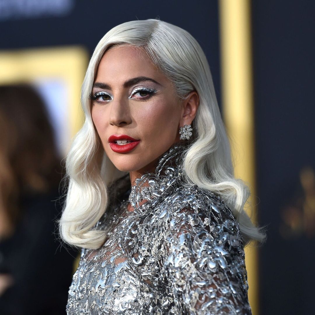 Lady Gaga ofrece medio millón de dólares por recuperar a sus mascotas robadas