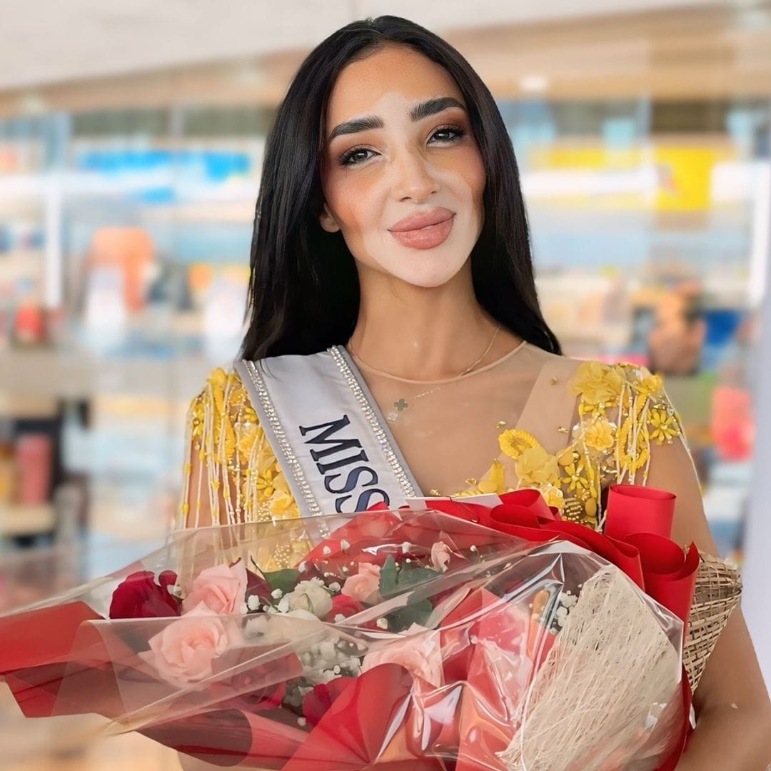 Logina Salah, la primera concursante de Miss Universe con vitíligo: ‘Me ha hecho una persona mucho más fuerte’