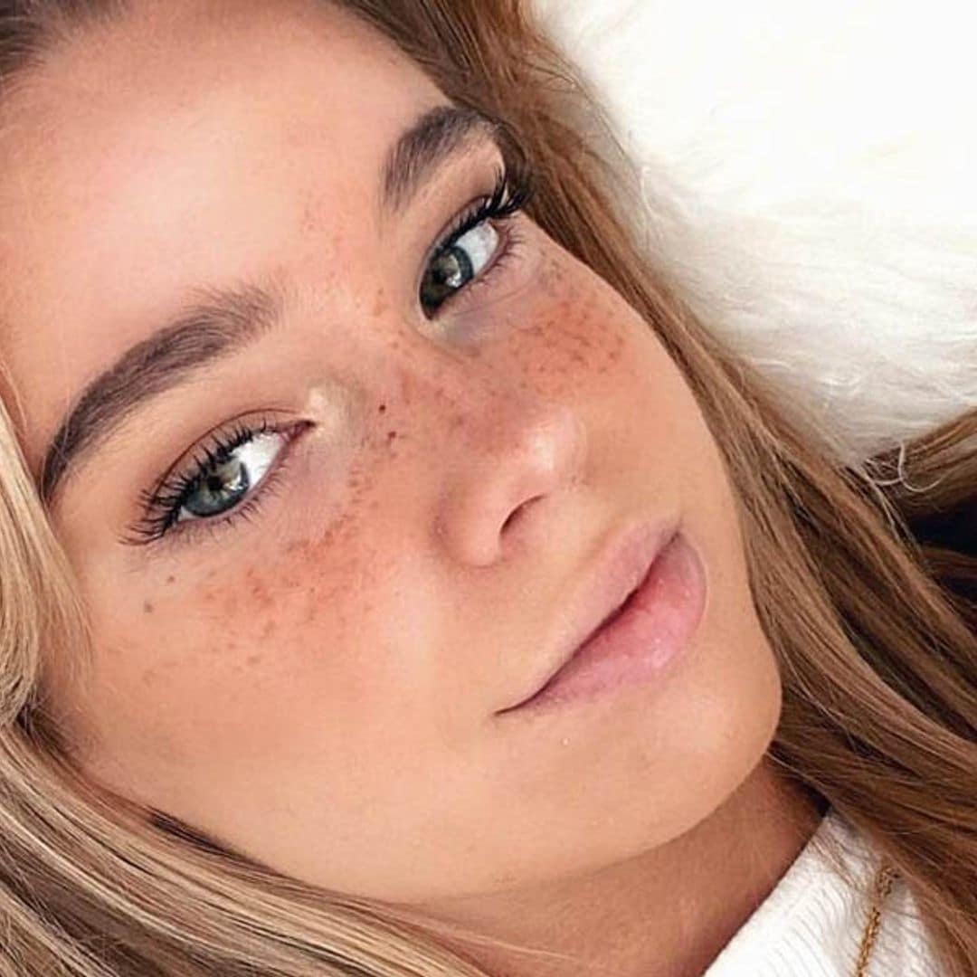 Pecas falsas: 6 trucos superfáciles para unirte a la tendencia 'beauty' que vuelve para arrasar