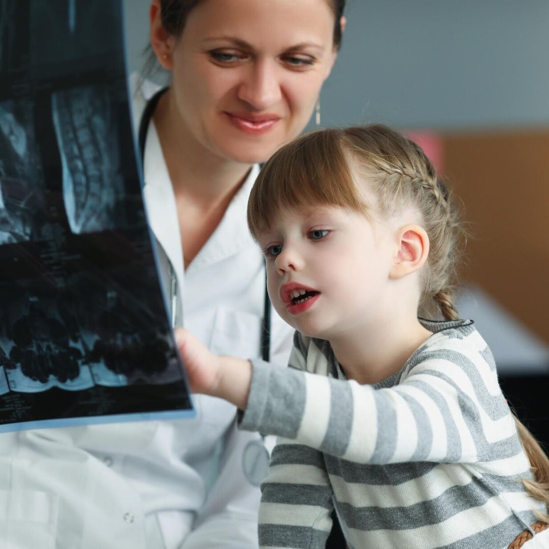 Radiografías, resonancias y TAC en niños, ¿qué debes saber?