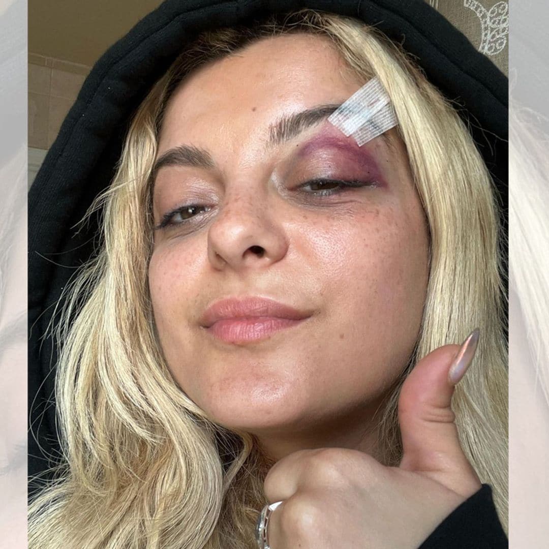 Bebe Rexha se desploma en un concierto tras ser golpeada por el móvil que le lanzó un fan