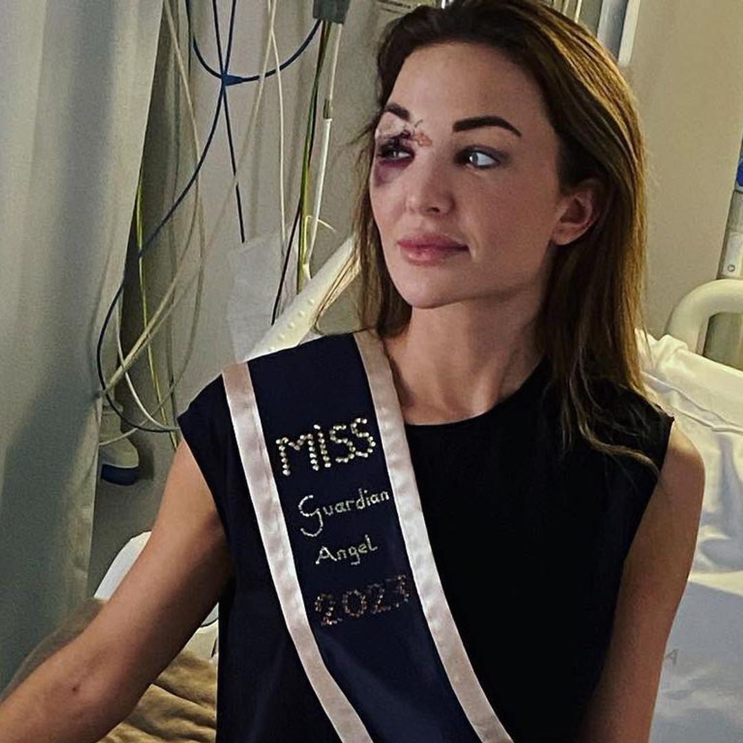 Miss Bélgica reaparece desde el hospital tras sufrir un aparatoso accidente automovilístico