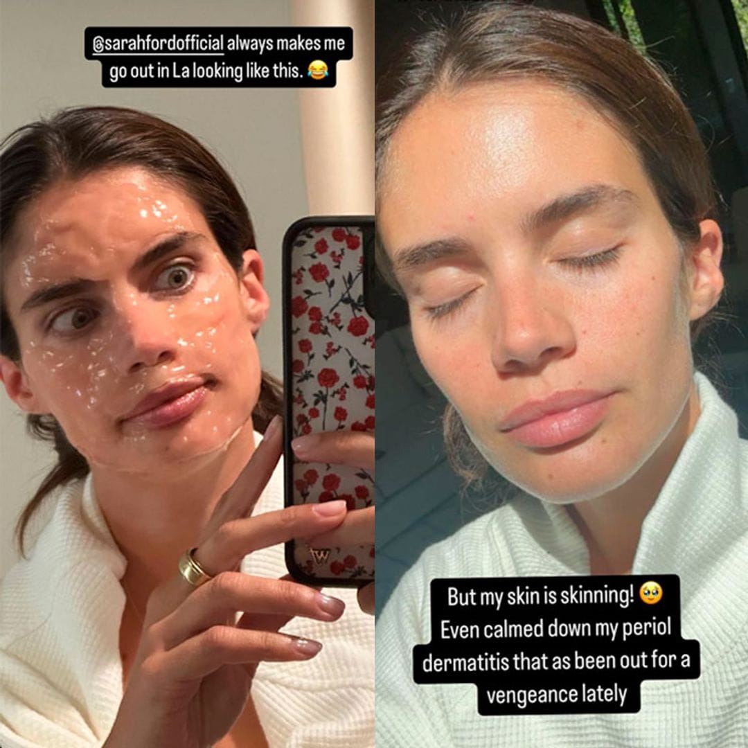 Sara Sampaio después de su tratamiento