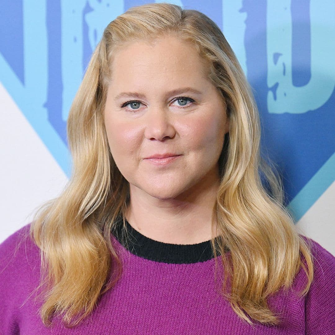 Amy Schumer explica el motivo por el que tiene la cara tan hinchada