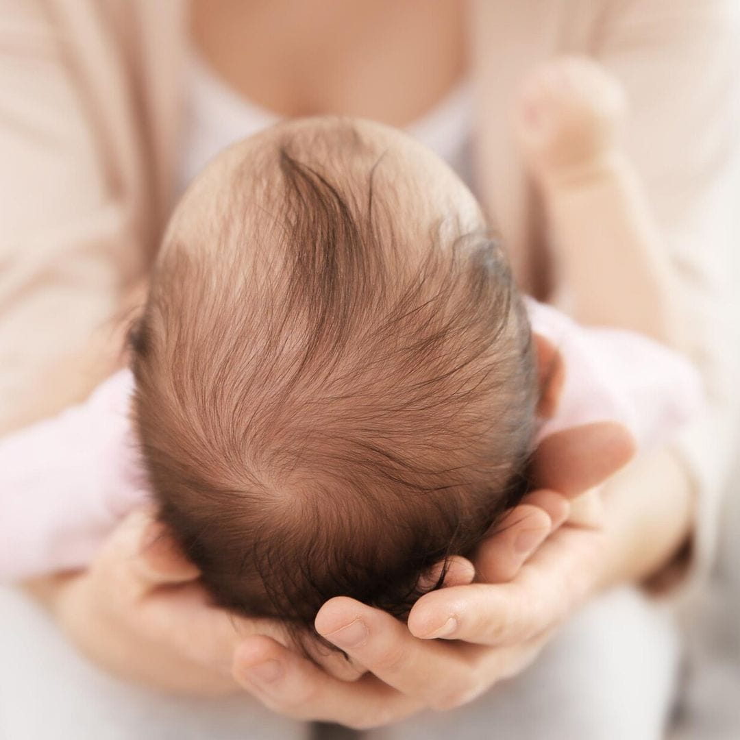 ¿Es normal que mi bebé tenga calvas en el pelo?