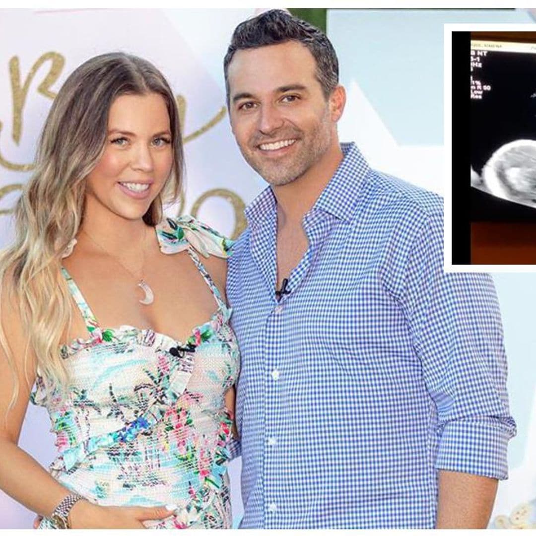 Ximena Duque y Jay Adkins comparten el ultrasonido de su bebé