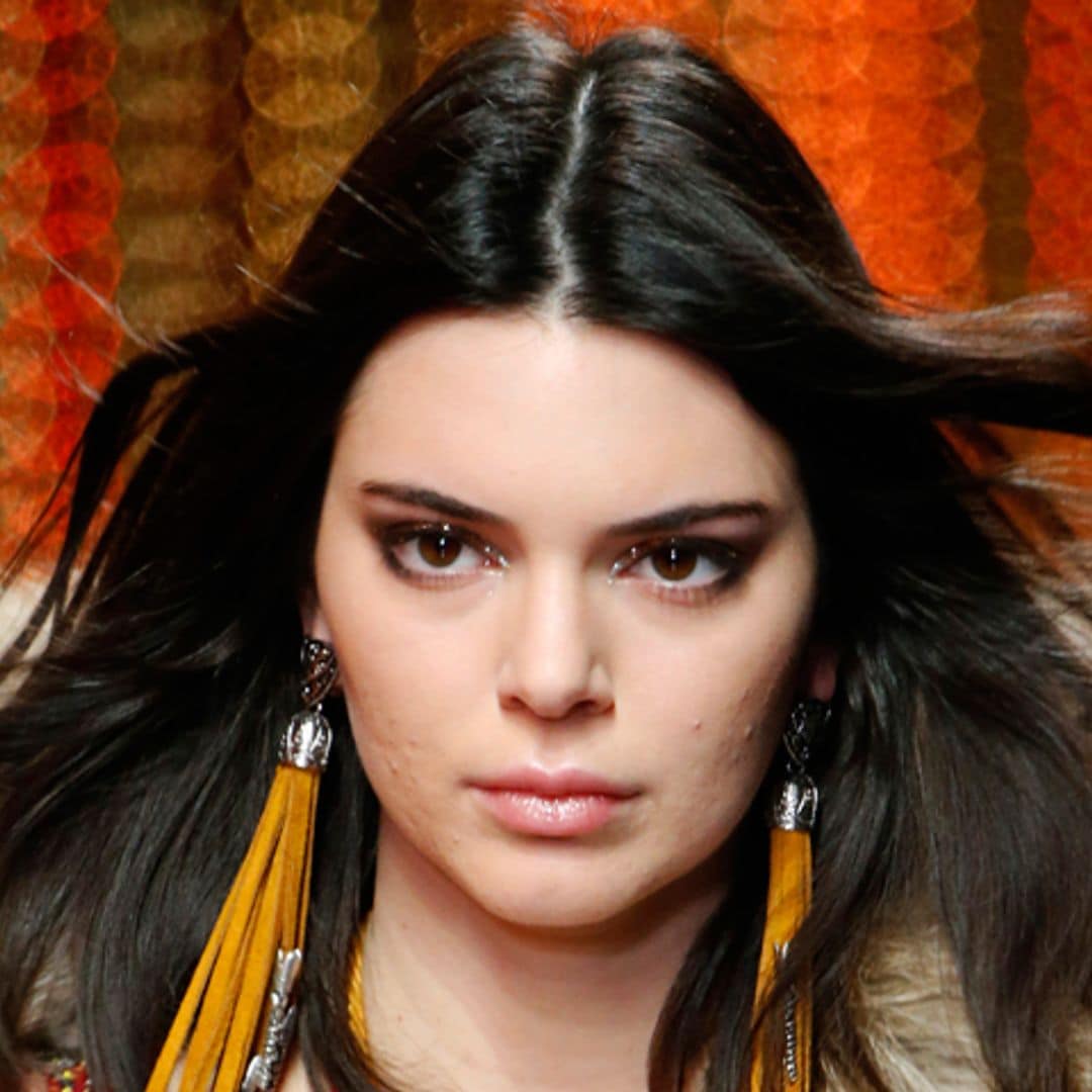 No estás sola Kendall Jenner, estas 'celebrities' también sufren problemas de acné