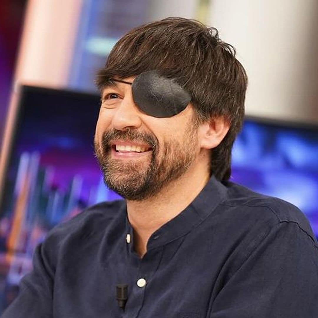 Luis Piedrahita aparece en 'El Hormiguero' con un parche en el ojo, ¿qué le ha pasado?