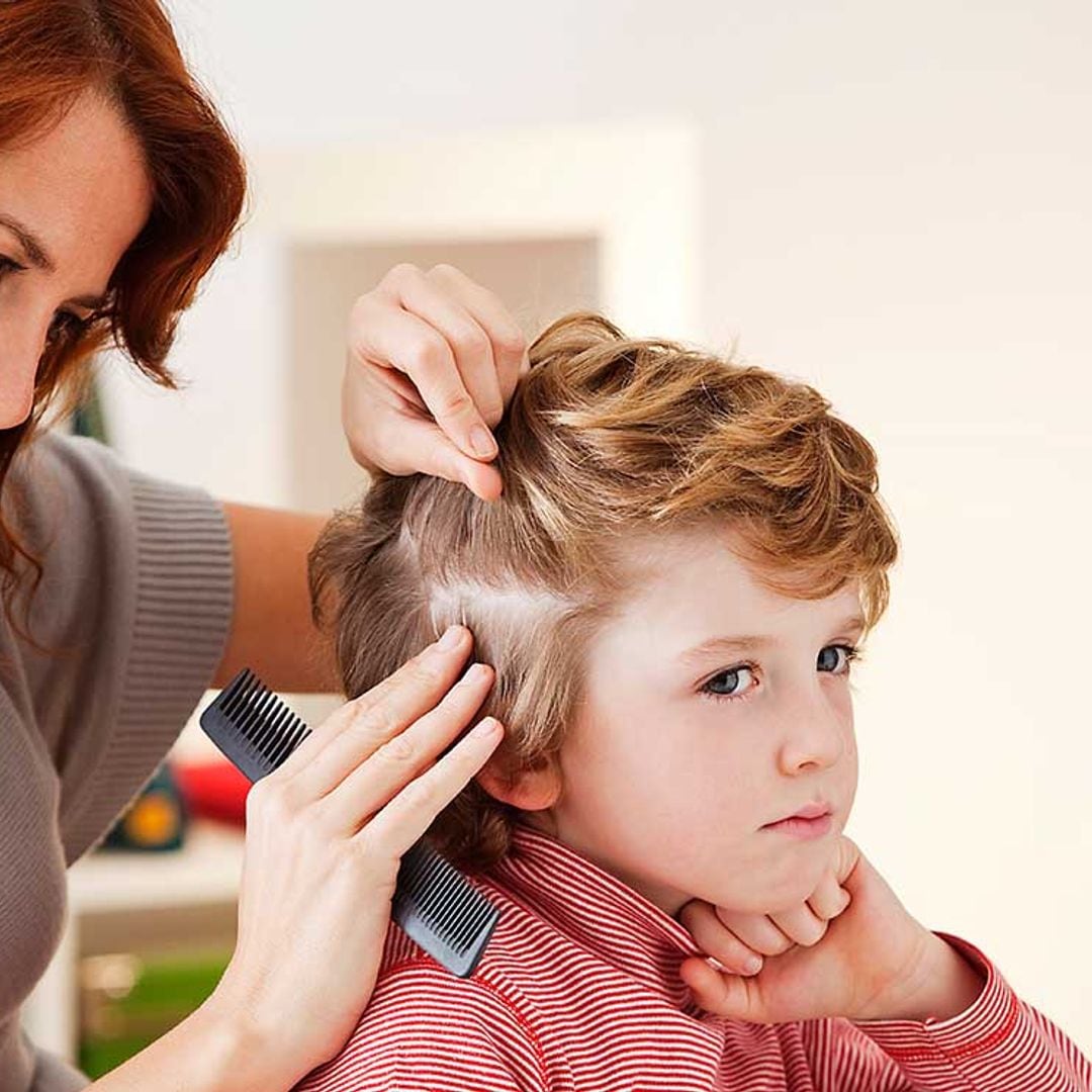 Si tu hijo tiene piojos, ¿tu mascota podría contagiarse?