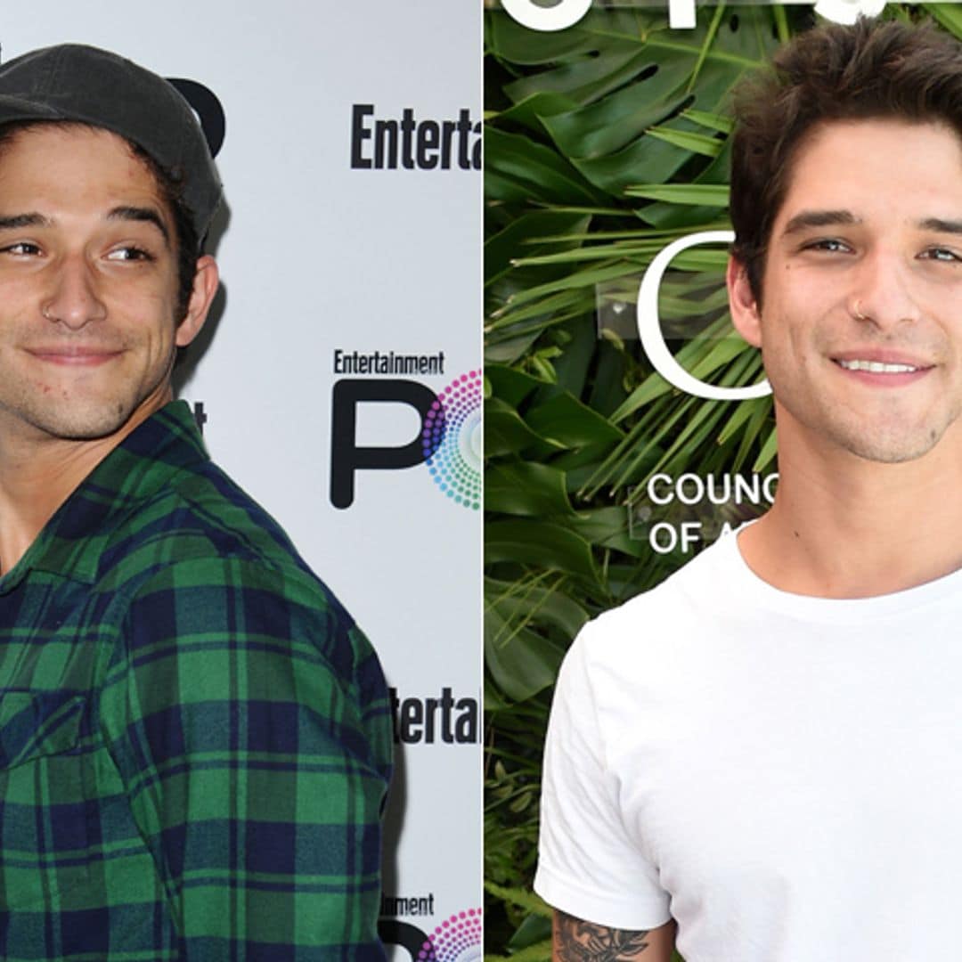 Cuidados para evitar la caída de cabello y presumir de melena tupida como Tyler Posey