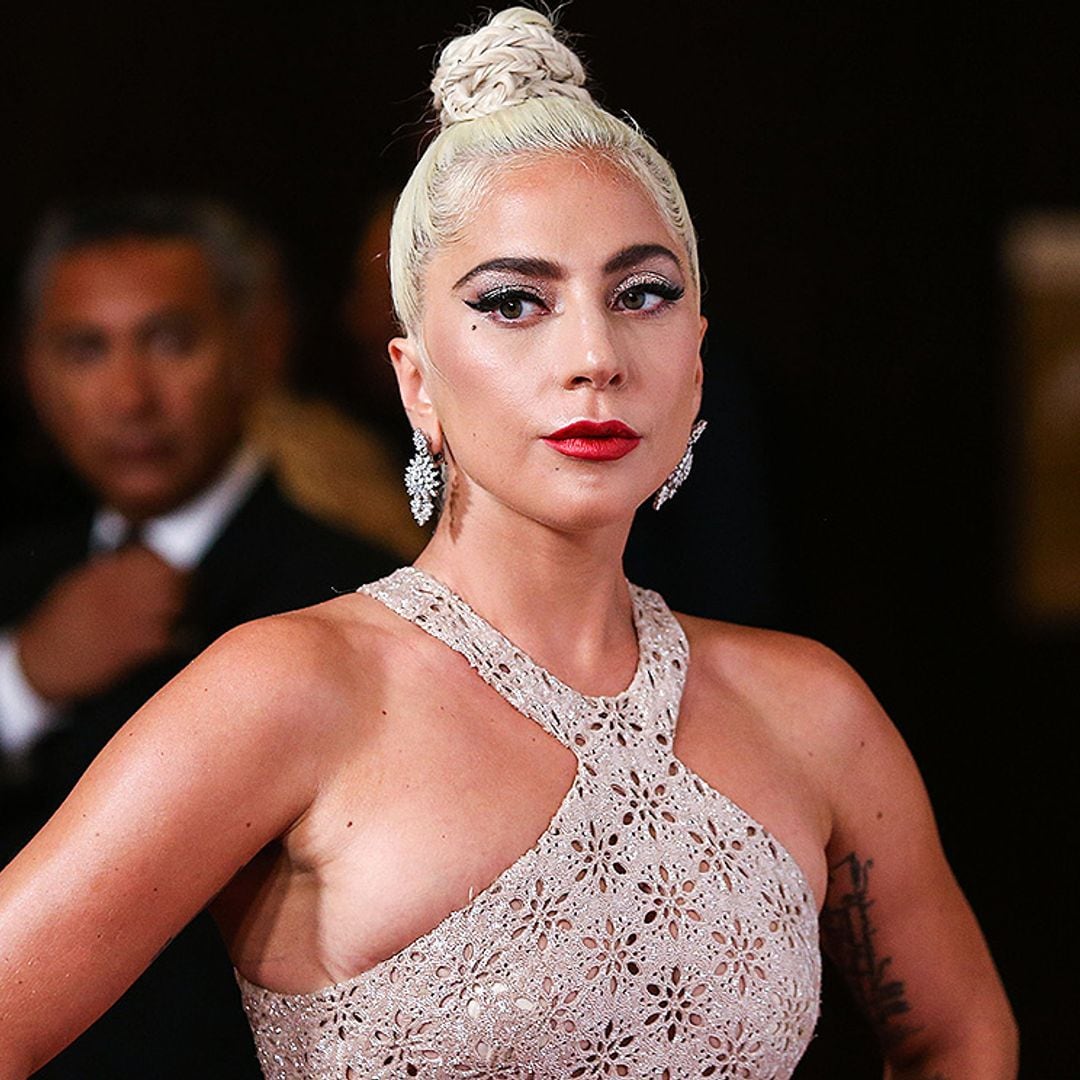 Roban dos de los perros de Lady Gaga tras disparar al hombre que los paseaba