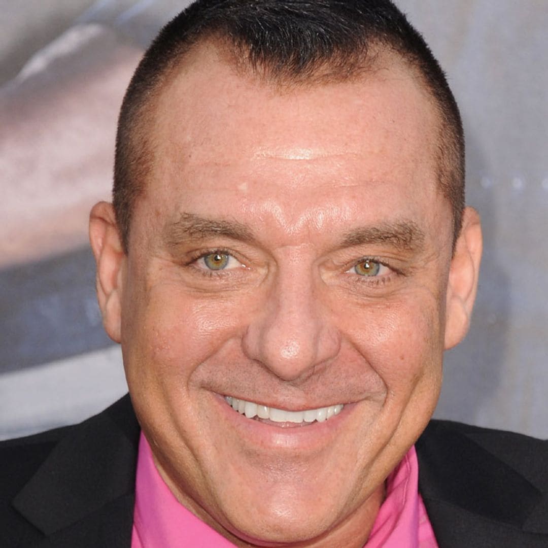 ¿Qué es el aneurisma cerebral por el que el actor Tom Sizemore está en estado crítico?