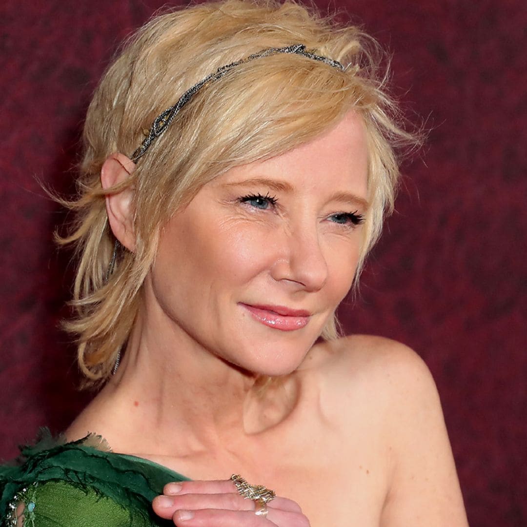 Anne Heche está en coma y sufre graves quemaduras en el cuerpo tras su accidente de coche