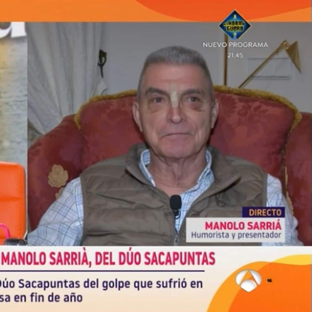 Manolo Sarriá, del ‘Dúo Sacapuntas’, sufre un aparatoso accidente doméstico