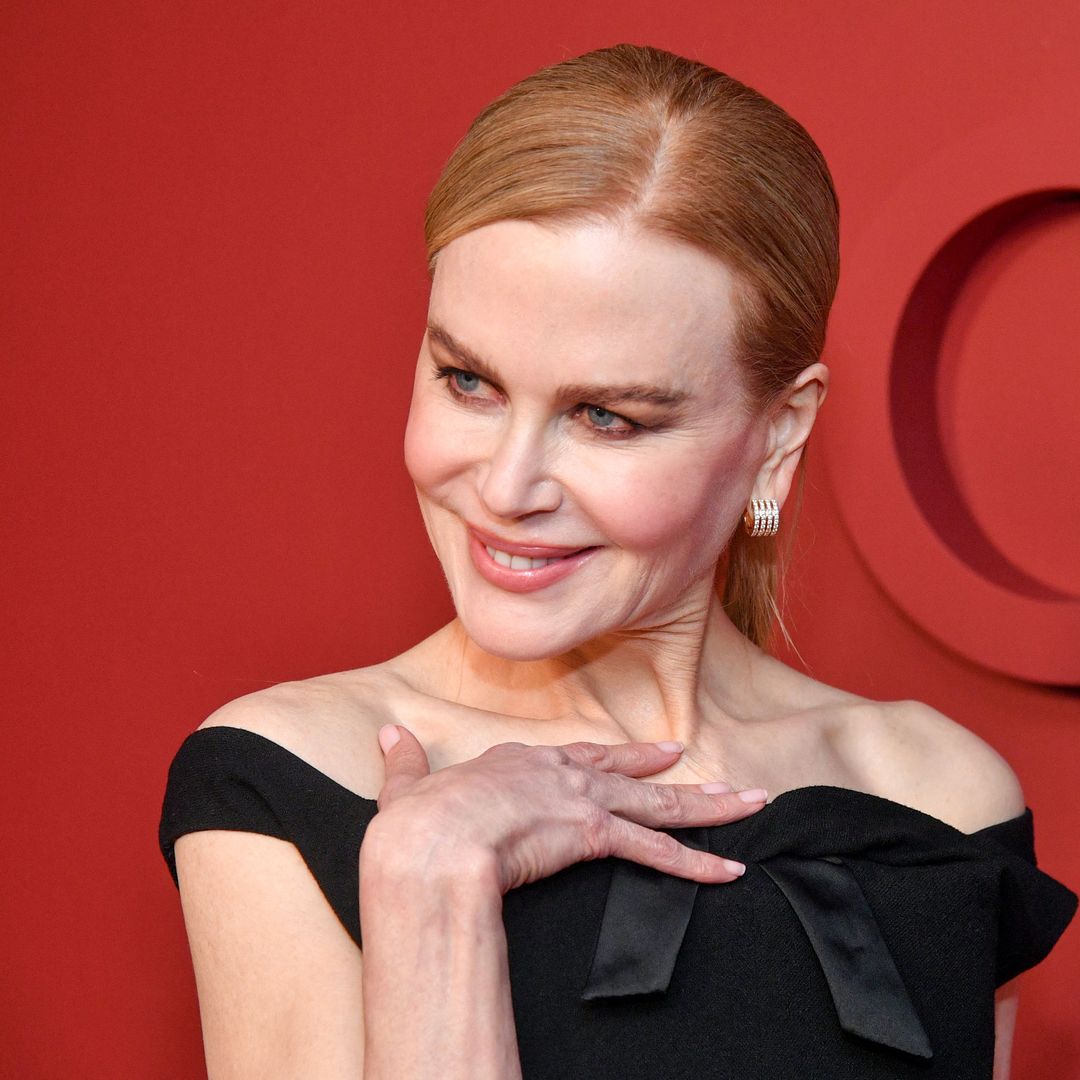 ¿Qué le suceden a los lóbulos de las orejas de Nicole Kidman?