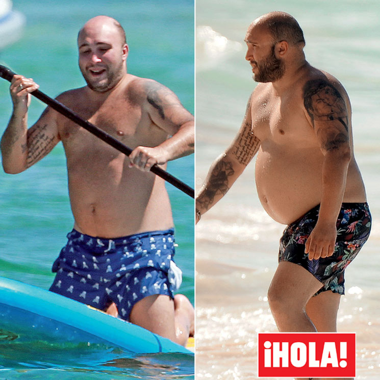 En ¡HOLA! Kiko Rivera, antes y después de su operación