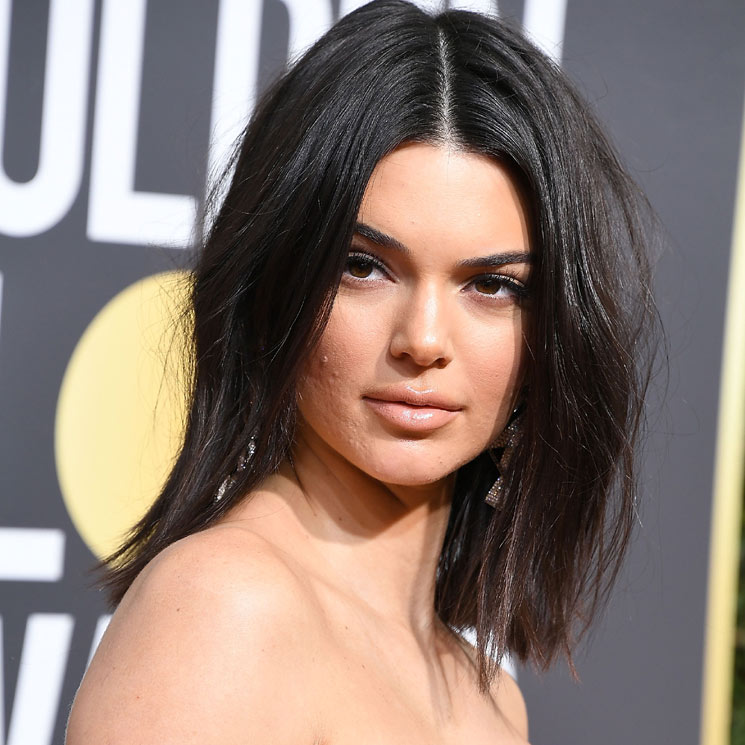 ¿Qué puedes hacer si tienes un brote de acné como el de Kendall Jenner? 