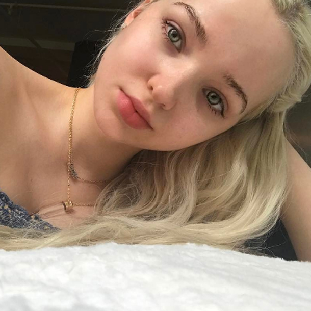 Dove Cameron sin maquillaje: consejos para tener una piel perfecta