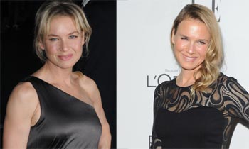 El cambio radical de Renée Zellweger