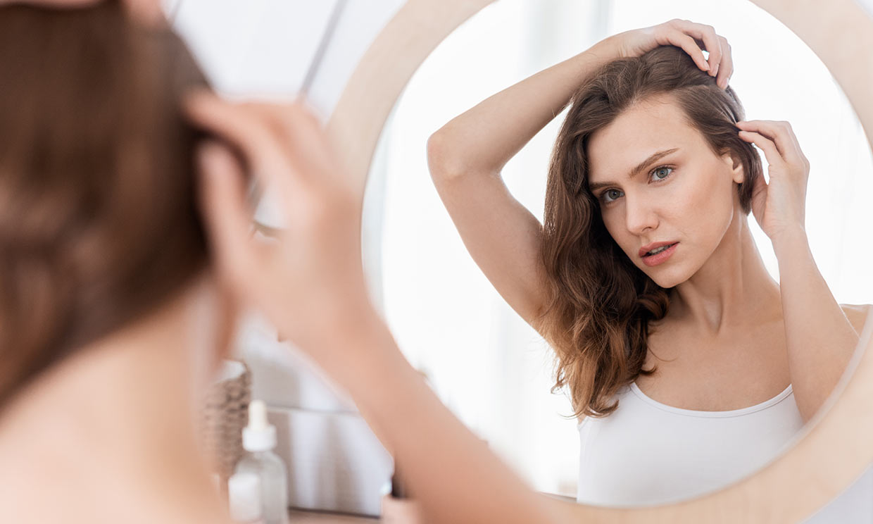 ¿Puede tener la psoriasis relación con la caída del cabello?