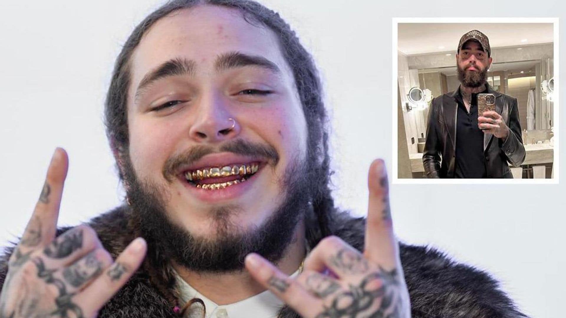 Post Malone shows off 55-pound weight loss and reveals his secret