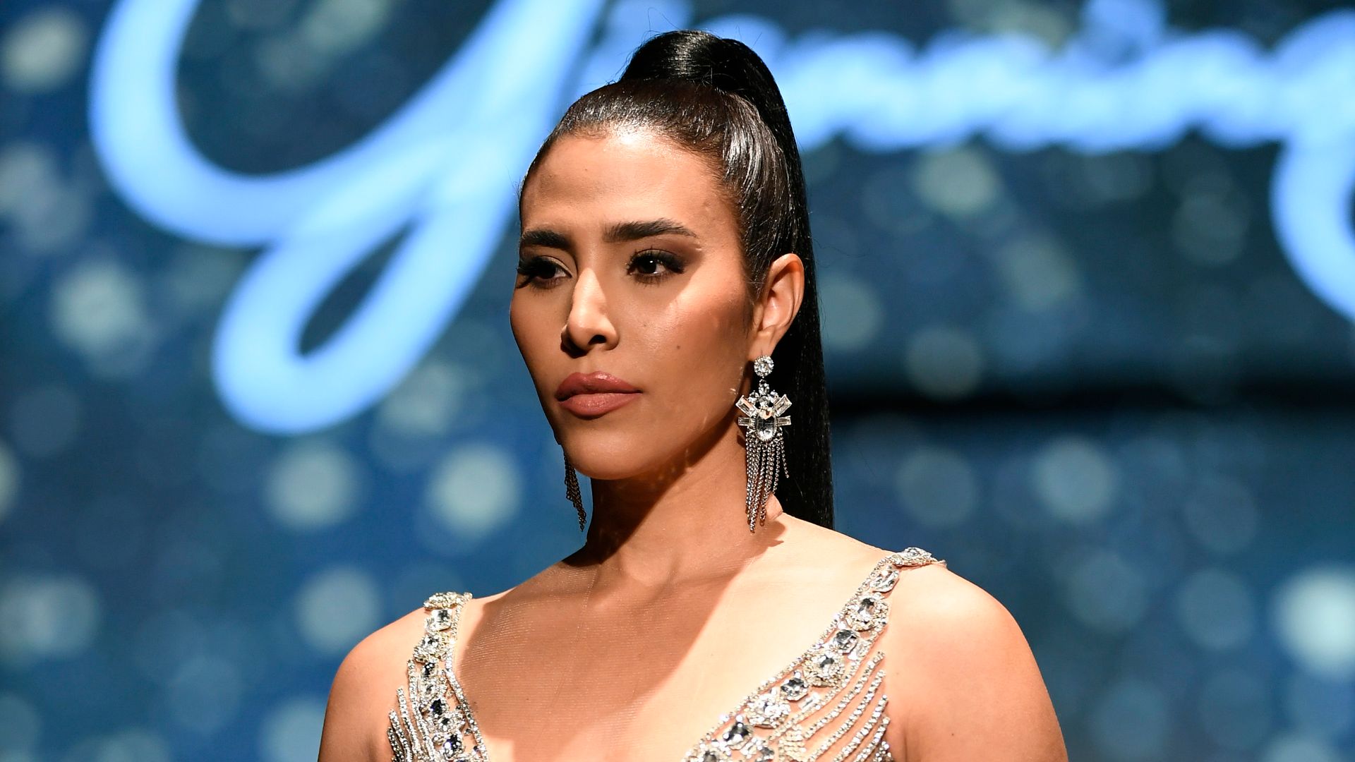 2021 Miss Dominican Republic reveals she suffered second-degree burns during pressure cooker explosion