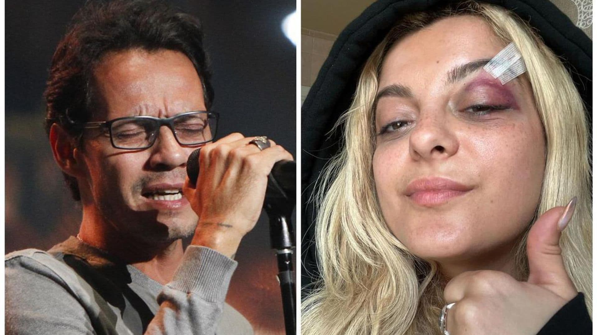 From Marc Anthony to Bebe Rexha: The stars who have got injured by fans throwing them items