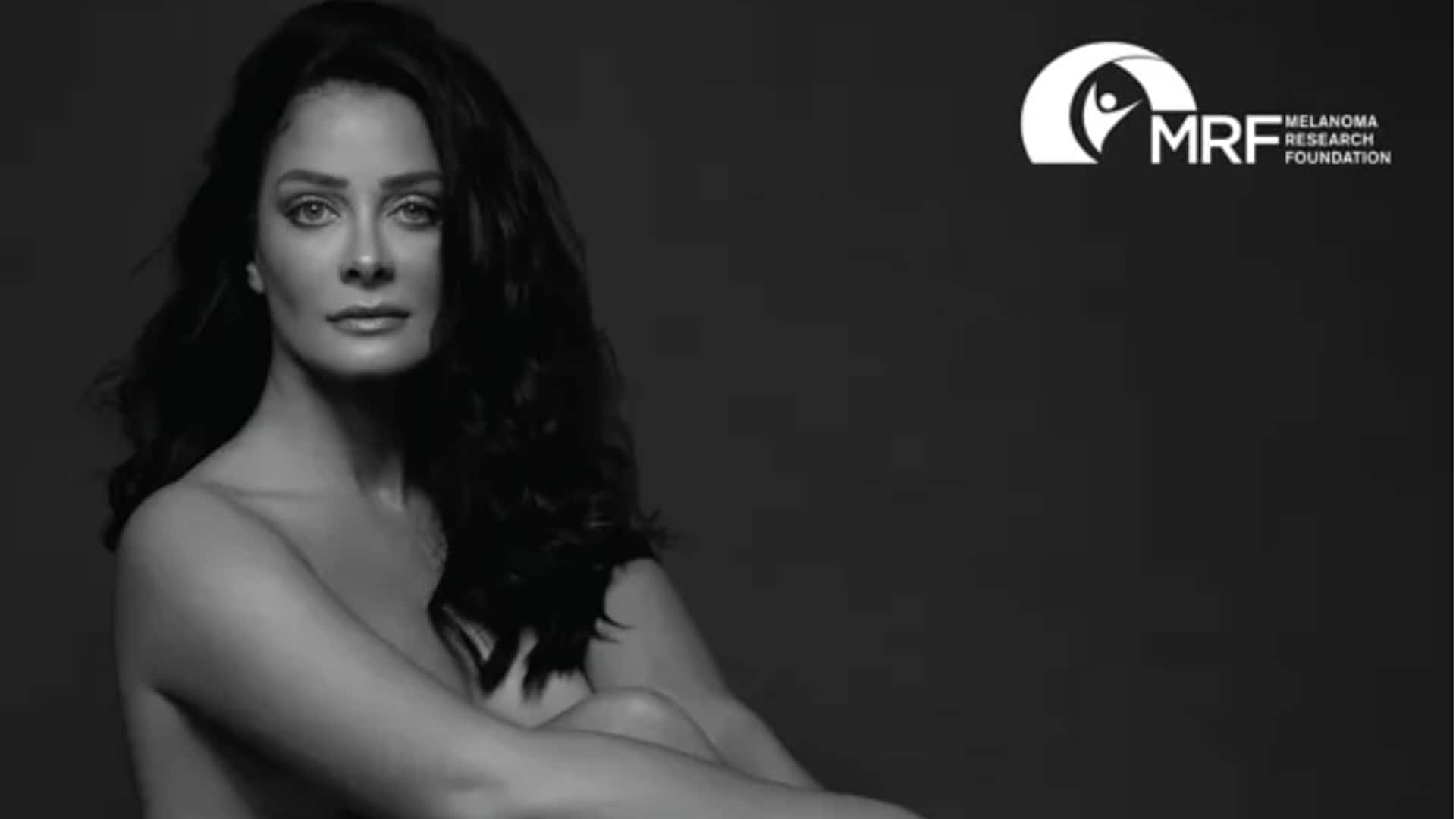 Dayanara Torres gets naked to raise awareness about Melanoma