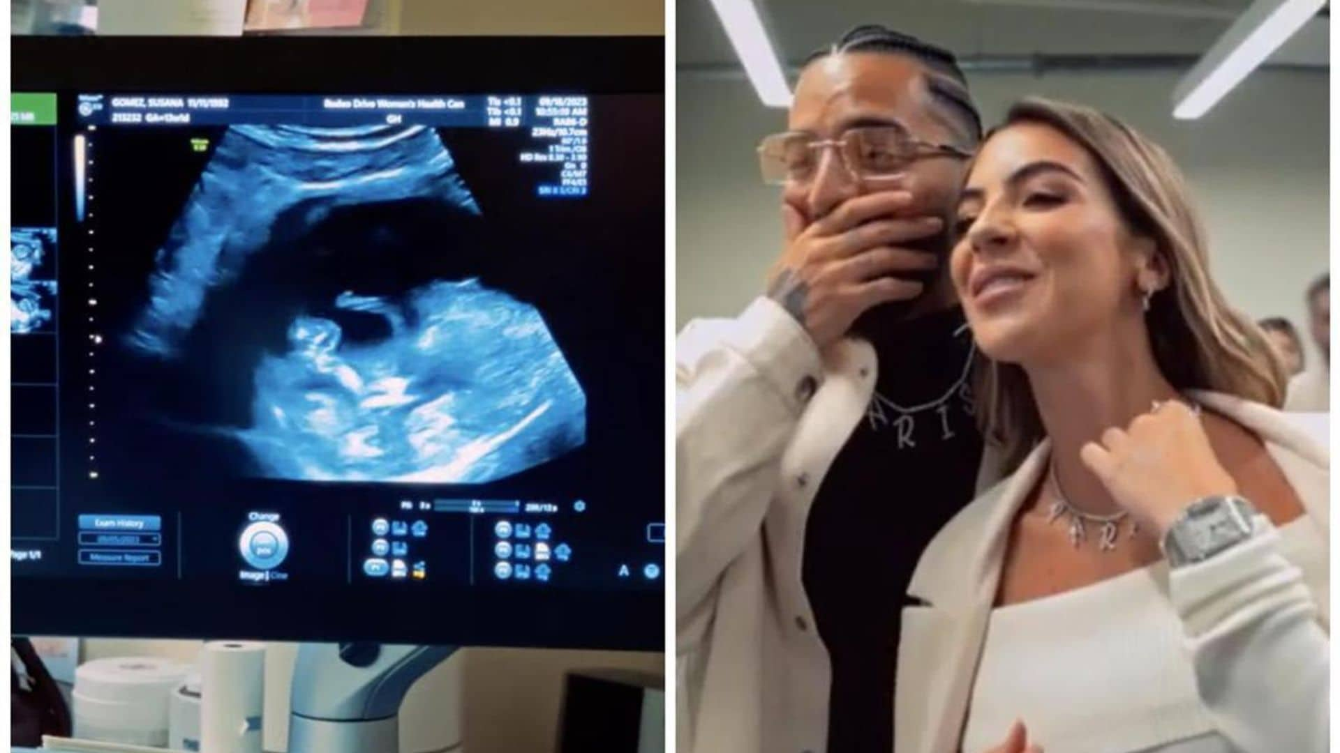 Confirmed: Maluma is expecting his first child with Susana Gomez