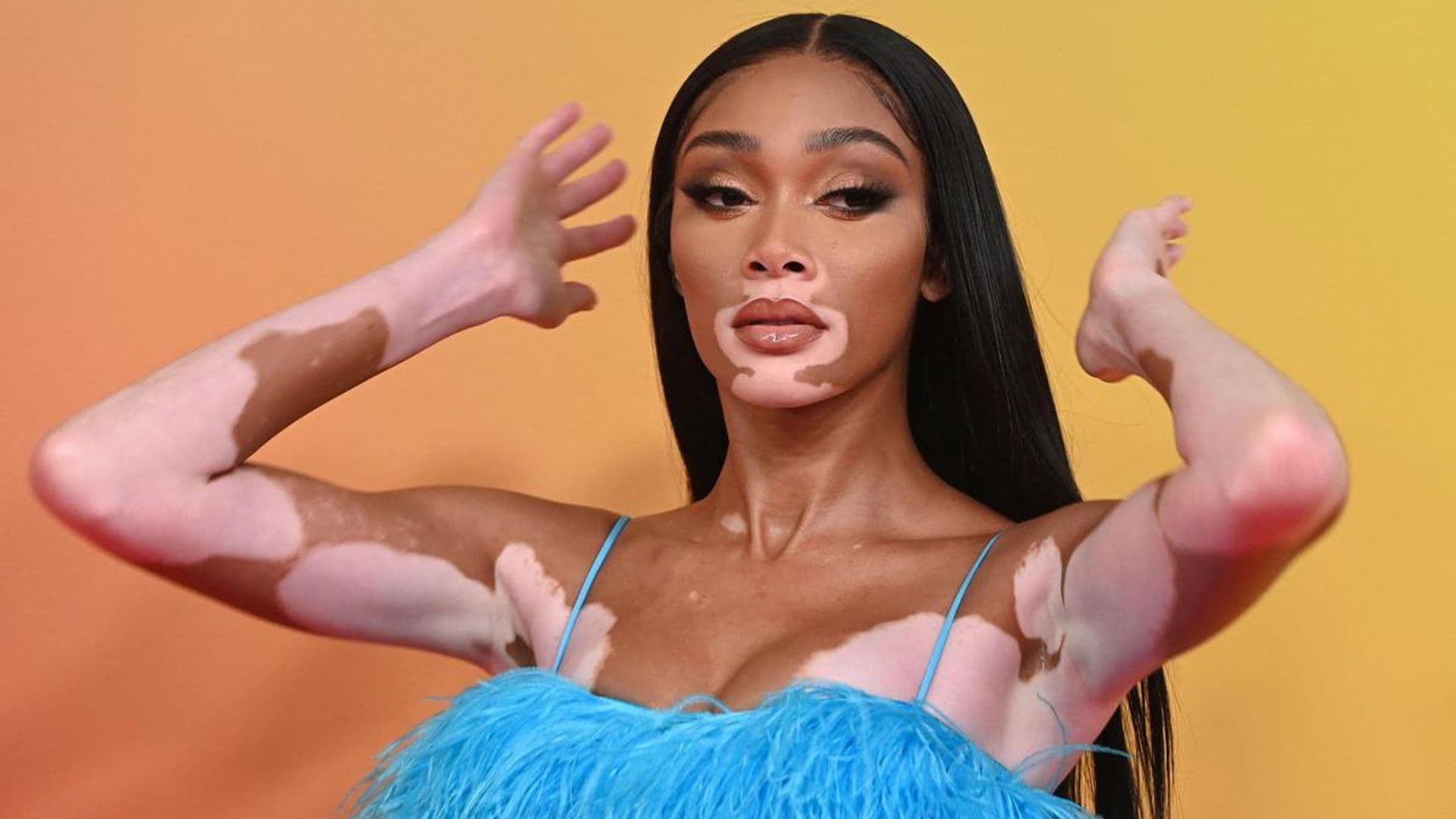 Winnie Harlow launches new skincare product after romantic holiday with Kyle Kuzma