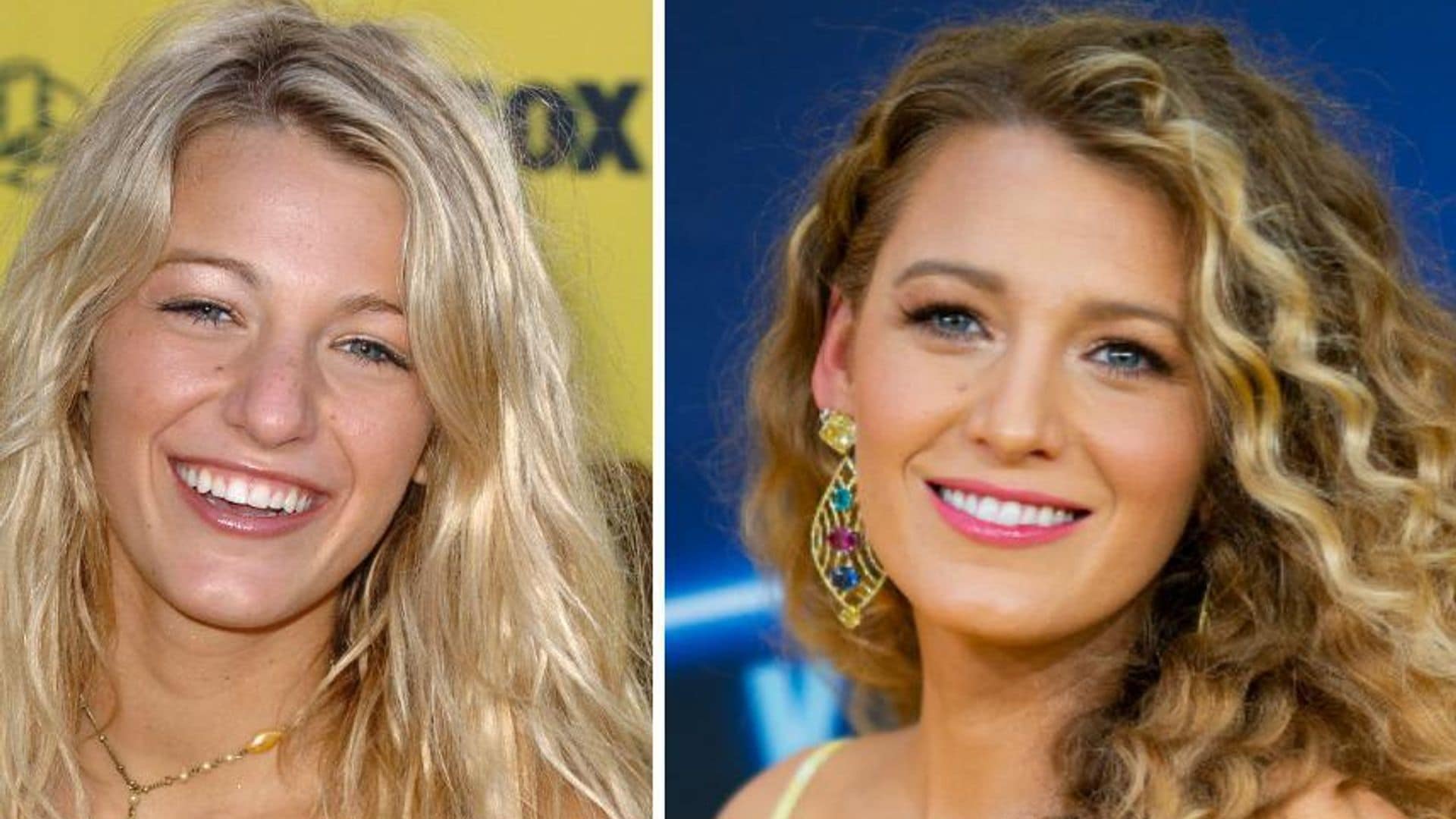 Cute both before and after! Blake Lively's gorgeous Hollywood transformation