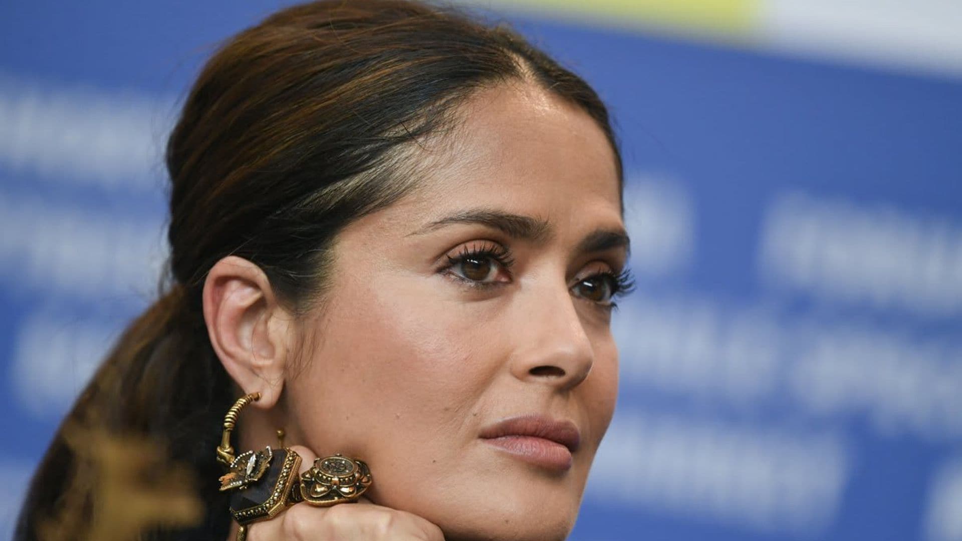 Salma Hayek posted a photo of herself recovering from an injury