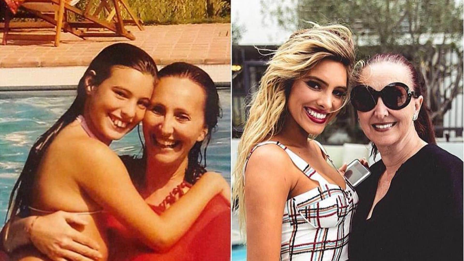 Lele Pons is the queen of cosmetic procedure before and after pics - and we can’t stop staring