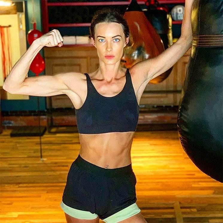 Emily Hartridge dies in scooter crash