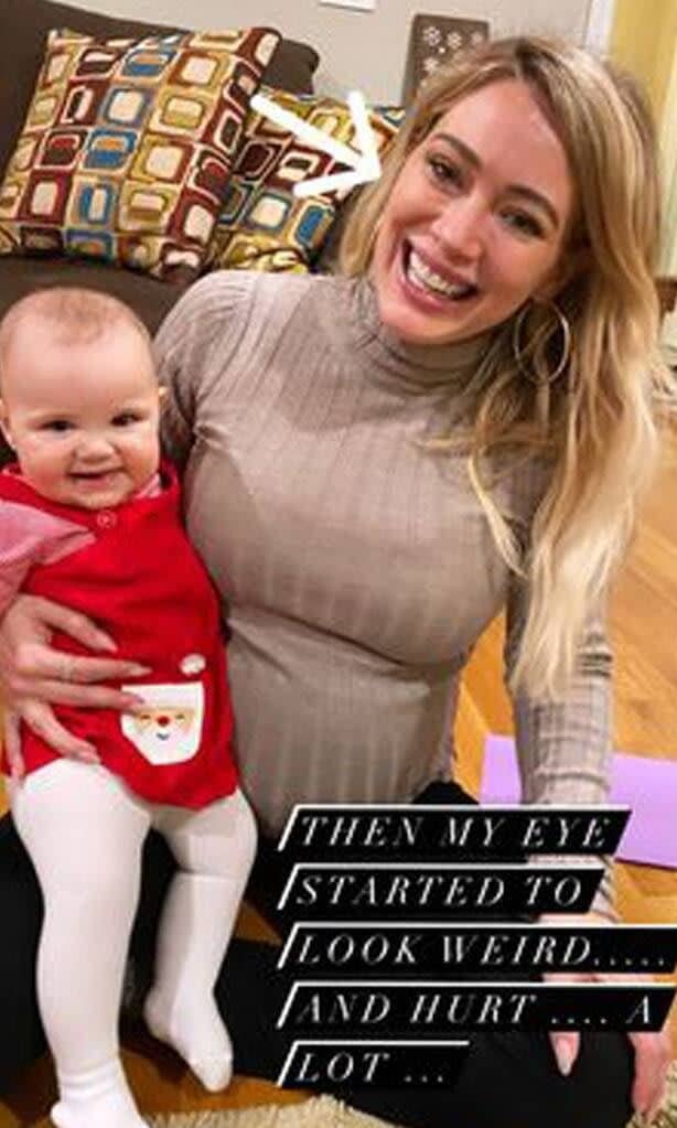 Hilary Duff claims COVID 19 tests gave her an eye infection