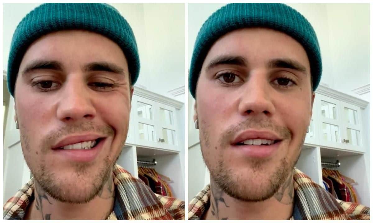 Justin Bieber has been diagnosed with Ramsay Hunt Syndrome