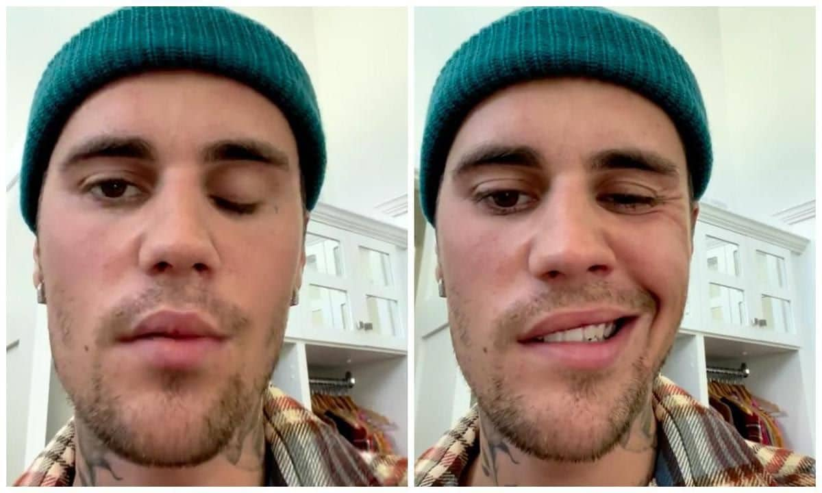 Justin Bieber has been diagnosed with Ramsay Hunt Syndrome