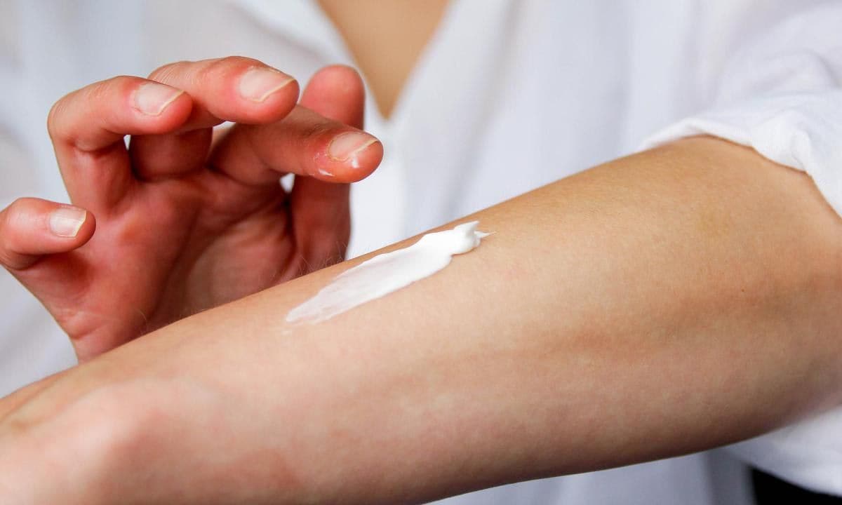 Topical creams can help relieve itching in the affected area.